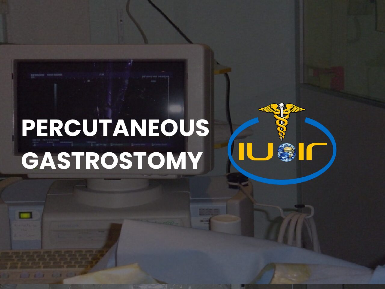 Percutaneous gastrostomy
