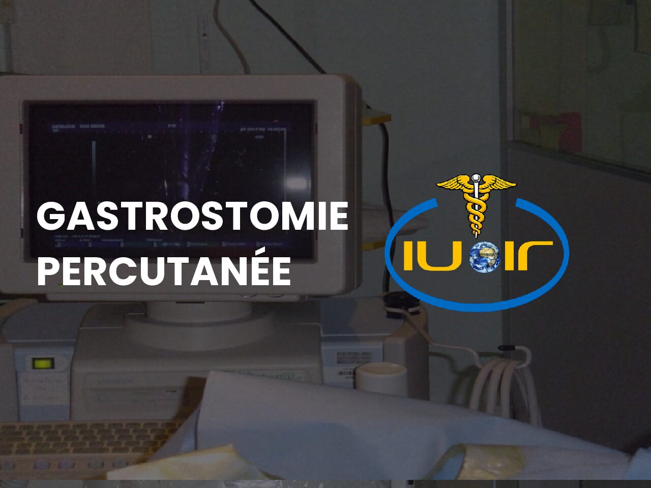 Gastrostomie percutanée